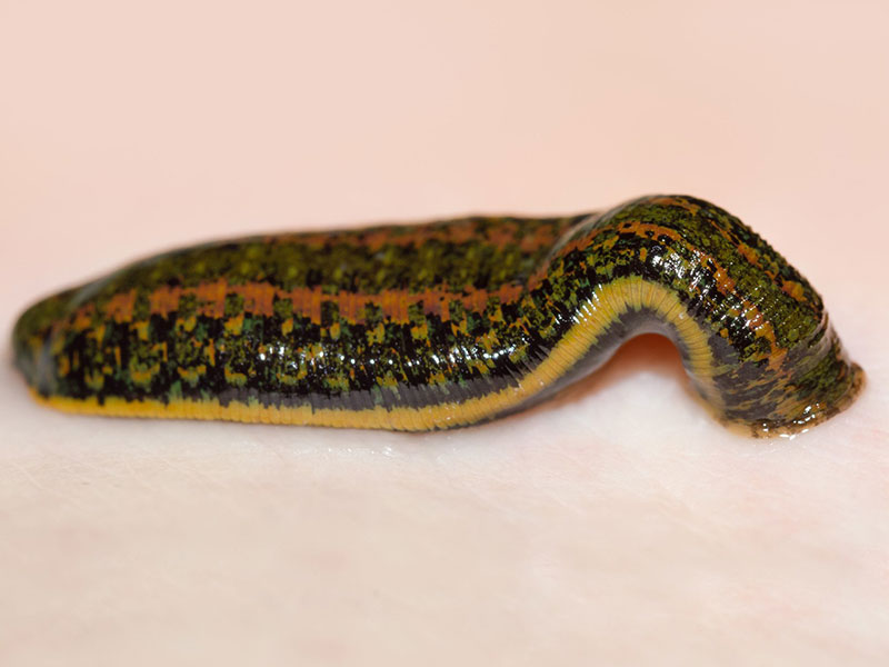 blutegeltherapie_800x600